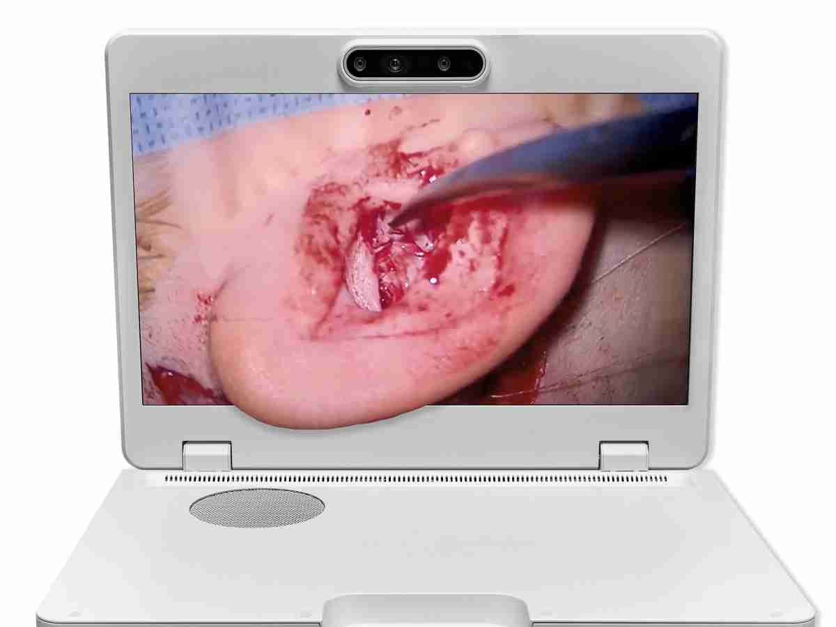 达擎之＂Heads-up 3D显微手术显示系统＂，，，整合4K裸眼3D显示及眼球追踪系统，，，具备快速追踪人眼移动位置功能，，减轻医师长时间维持固定姿势的负担，，，让医师能有更宽广清晰的3D立体视野及更舒适的姿势来执行手术。。